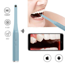 Load image into Gallery viewer, 1080phd-dental-camera