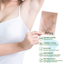 Load image into Gallery viewer, Sapphire IPL Laser Hair Removal Device | Xanxan | at Home Hair Removal